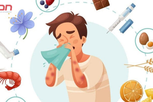 Hoy es Día Mundial de la alergia.