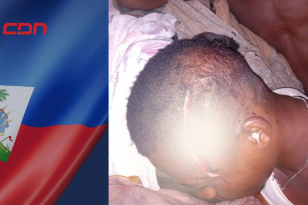 Más de 15 personas resultaron muertas durante un hecho de violencia entre miembros de la banda haitiana Los 400 Mawozo. Foto: CDN Digital 
