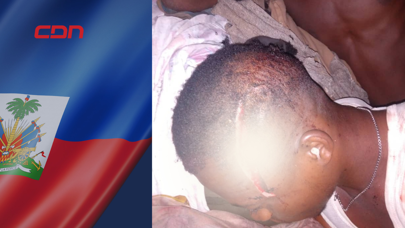 Más de 15 personas resultaron muertas durante un hecho de violencia entre miembros de la banda haitiana Los 400 Mawozo. Foto: CDN Digital