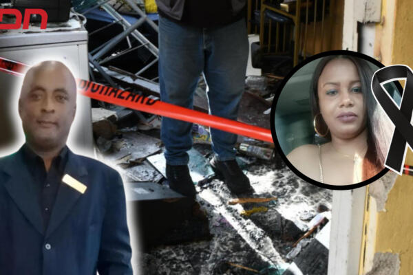 Manuel Encarnación Ortiz, quien se encuentra ingresado en la Unidad de Quemados del Hospital Ney Arias Lora. Foto CDN Digital