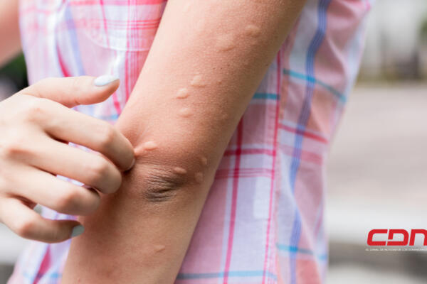 Hoy es Día Mundial de los Mosquitos. (2)