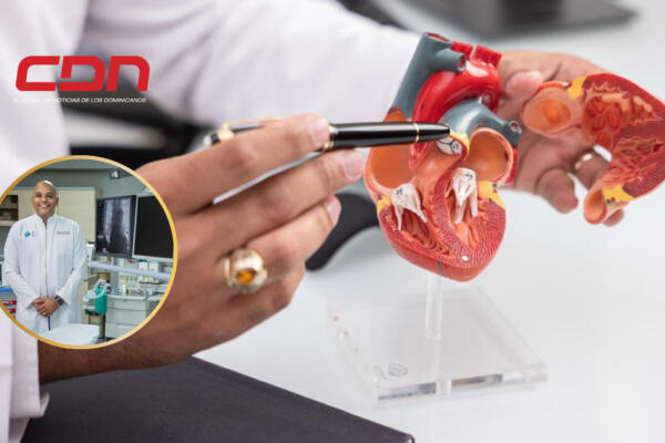 Con la aplicación de la misma se trata la ocurrencia de la Re Estenosis Intra Stent. Foto: CDN Digital 
