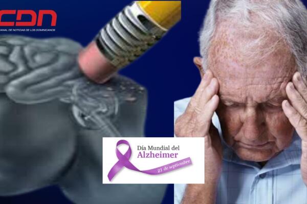 El Alzheimer es una enfermedad en aumento. Foto: CDN Digital 