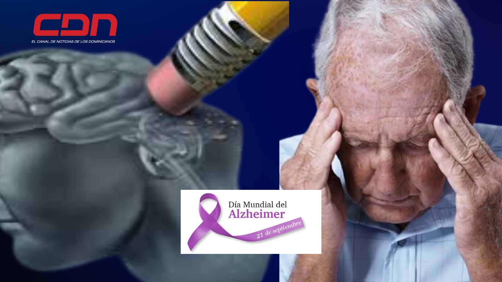 Alzheimer