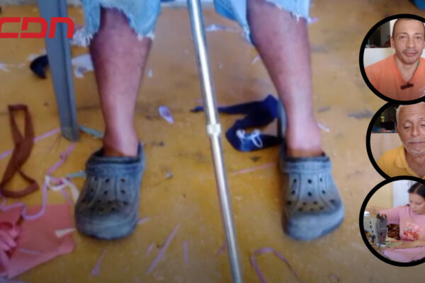Miembros de familia que sufre condición física en la comunidad Las Caoba