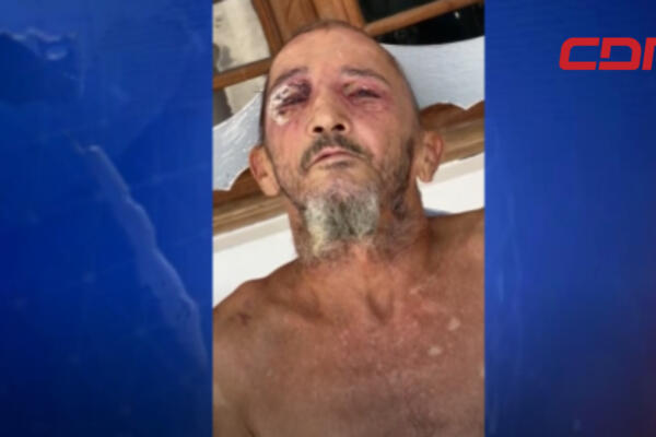 José Espinal, de 58 años, agredido presuntamente por vecinos. 