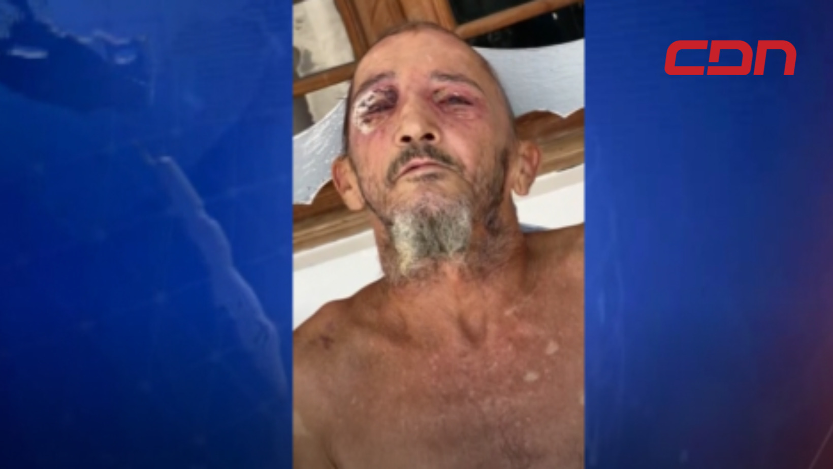 José Espinal, de 58 años, agredido presuntamente por vecinos.