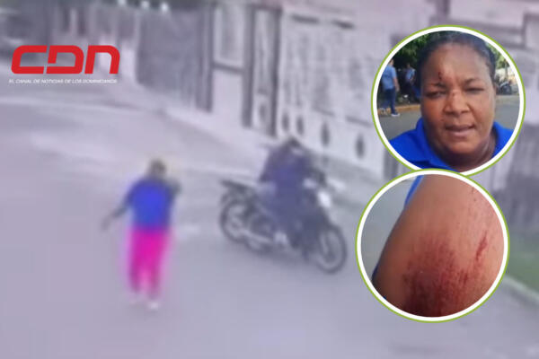 La hicieron caer de la motocicleta para robarla.  Foto: CDN Digital 