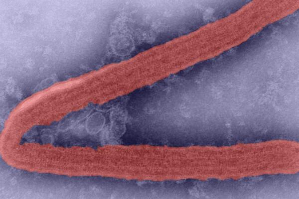 Alerta de la OMS por brote de virus de Marburgo en Ruanda