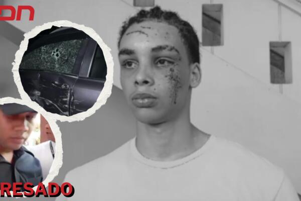 Wismi Alexander Collado, joven agredido por policía