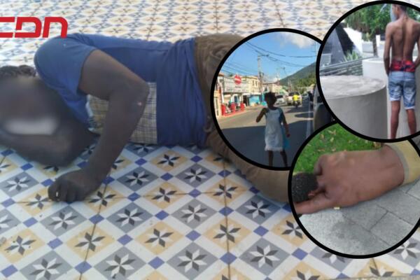 Enfermos mentales que deambulan en calles de Villa Altagracia. 
