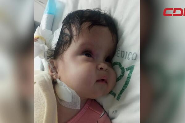Sus padres piden la ayuda de la comunidad para poder costear la cirugía.