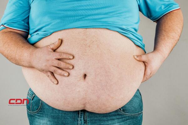 Hoy es Día Mundial contra la Obesidad.(foto, fuente externa)