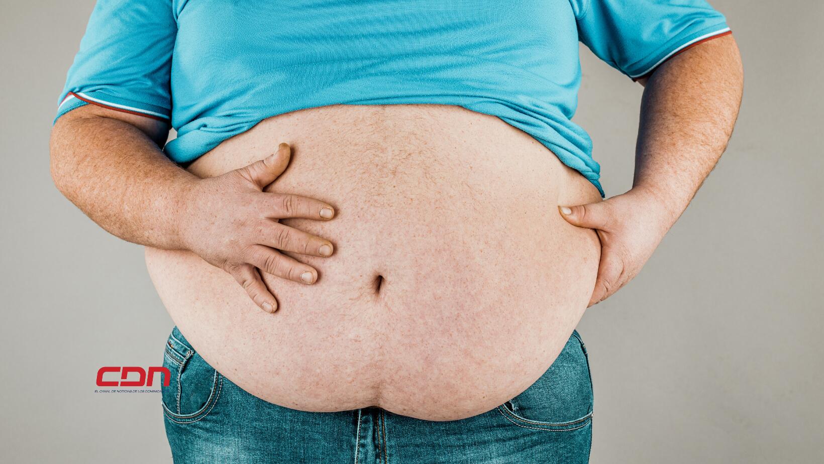 Obesidad