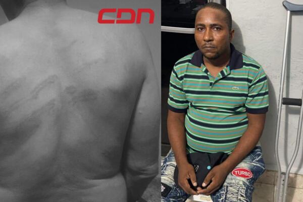 Reynold Valdez, prestamista que agredió abogado.
