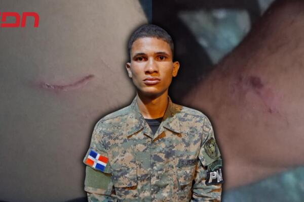 Joel Alejandro Alcántara Sánchez, raso agredido por agentes. 