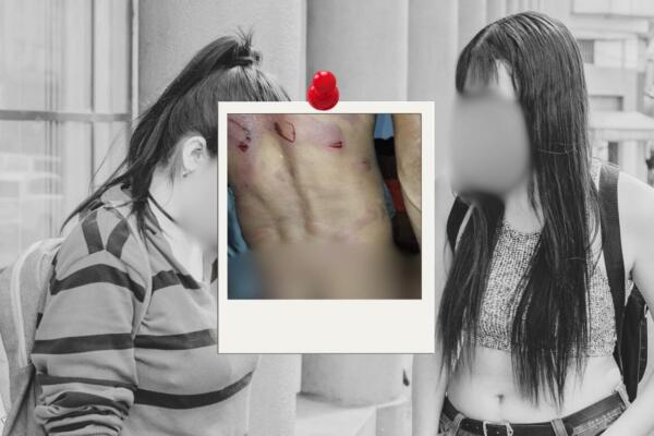 La víctima recibió atenciones medidas en un hospital de SFM
Foto: CDN Digital