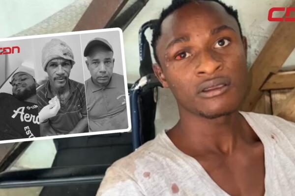 Ericson Messesu, herido en enfrentamiento con dominicanos. 