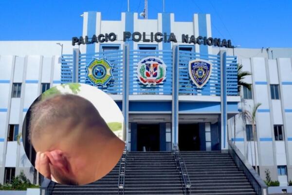 Agentes de la Policía Nacional agreden ciudadanos en Hato del Yaque.