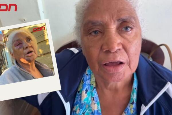 Juana Perdomo Castillo, envejeciente agredida por un grupo de personas en Villa Altagracia. 