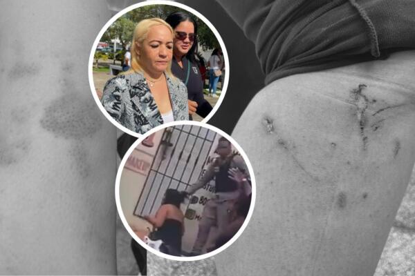 Mujeres agredidas por agentes policiales en Nagua.