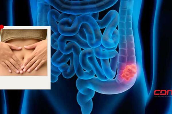 diagnosticada en noviembre del 2021 con cáncer de intestino estadio IV. Foto. Fuente externa 