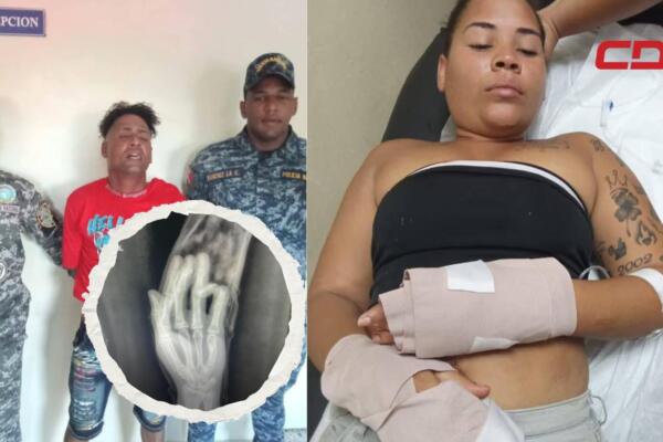 La víctima, Yarmeli de los Santos, negó la acusación de robo. 
