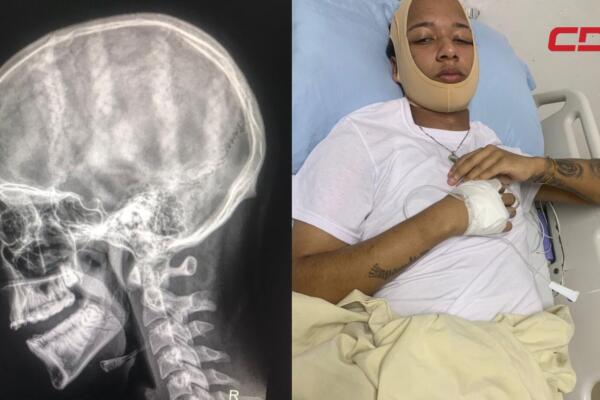 Maiky Raúl Fortuna, joven presuntamente agredido por conductor de Uber. 