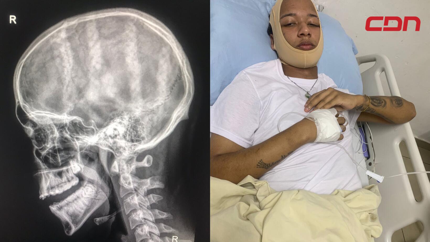 Joven agredido por Uber