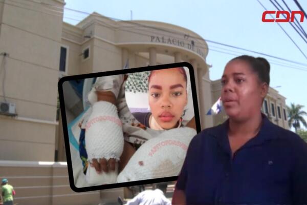 Se trata de Vinelsa Yamilet, quien alegó se trató de un accidente en el hogar quemaduras de su hijo en las manos.  