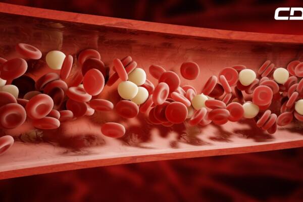 Coágulos de sangre: ¿Cuáles síntomas presenta y cuándo debo asistir al médico?