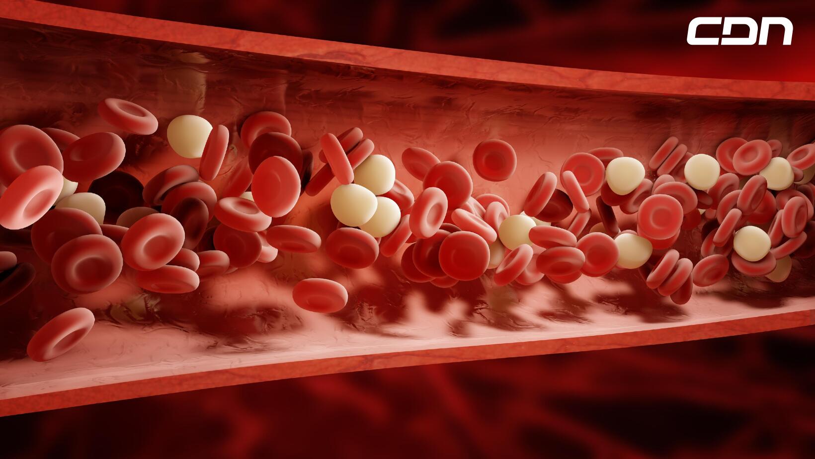 Coágulos de sangre: ¿Cuáles síntomas presenta y cuándo debo asistir al médico?