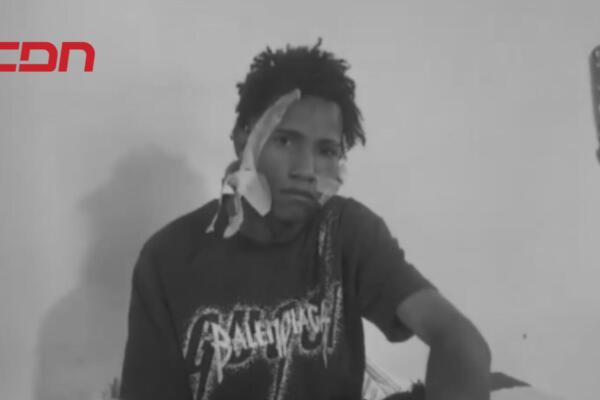 Wilkin Sharlin López Reyes, joven herido de bala en la cara.