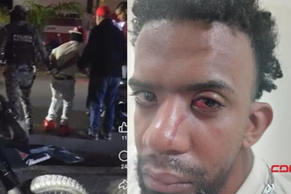 Aseguró que a su hijo Carlos Emilio Lagual Vargas, quien padece el síndrome de Noonan. Foto: Fuente externa 