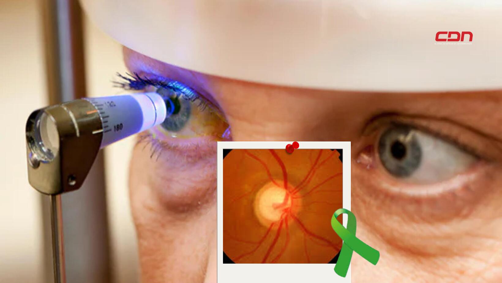 glaucoma