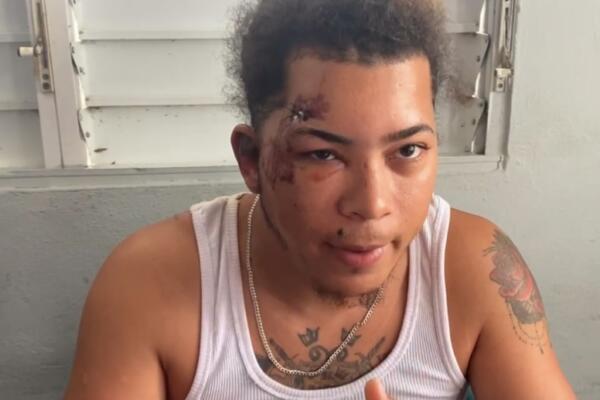 El tiktoker “Bokita RD” terminó apresado por la Policía Nacional tras falsamente difundir que se encontraba entre las víctimas de Jet Set.