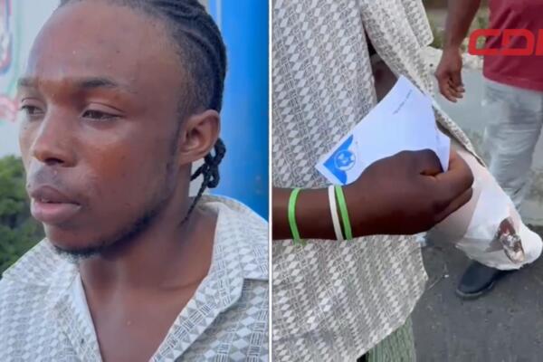 Nacional haitiano herido por su pareja en Hato Mayor. 