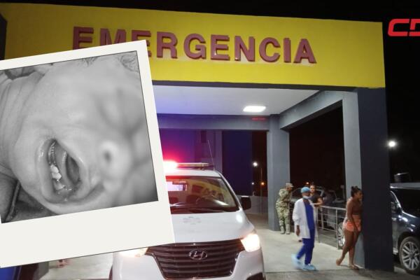 Bebé con tres dientes nace en hospital de Barahona y causa asombro. 
