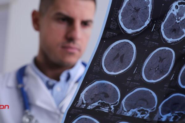 Esclerosis Tuberosa, afecta especialmente en el cerebro.