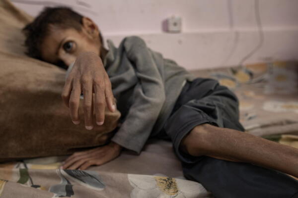 Más de 5.100 niños en Gaza en desnutrición aguda en mayo en medio del bloqueo israelí