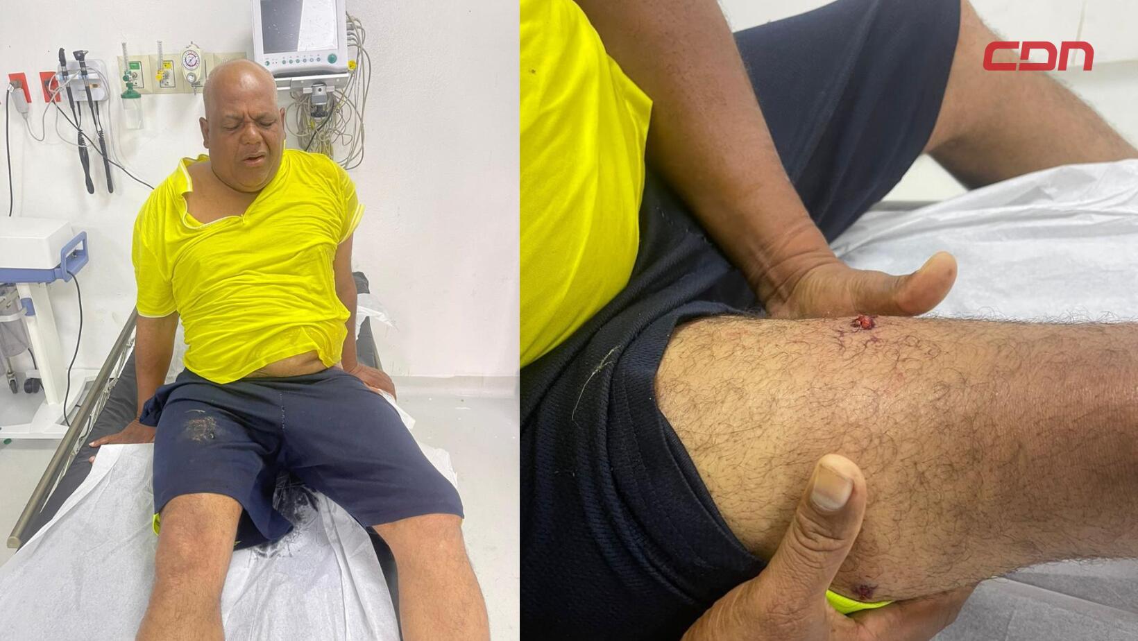 Apresan a “Adancito Caballo Blanco” tras herir a seis haitianos