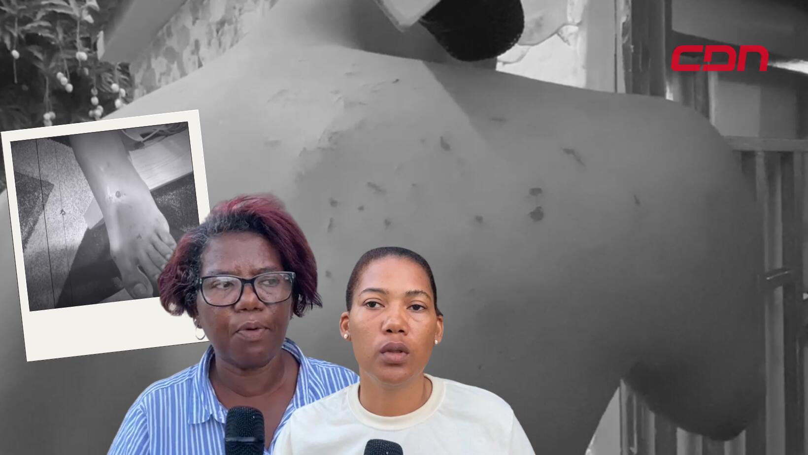 Familia denuncia tortura policial contra joven en Hato Mayor; piden investigación