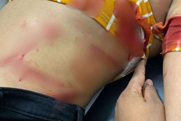 Yulissa Ramos dijo que había tenido diferencias familiares con su excuñada. Foto externa