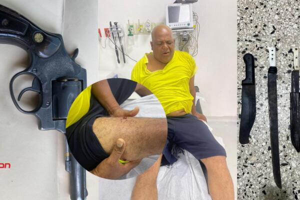 A Santos “Adancito Caballo Blanco” lo acusan de herir con arma blanca a seis extranjeros a quienes despojaba de su cartera y celulares. Foto: Fuente externa 