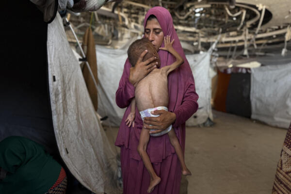 El pequeño gazatí Mohamed Motawaq, de tan solo 18 meses, de cuerpo esquelético pasa los días en Gaza en brazos de su madre, Hidaya, un mujer viuda, de 30 años, sin apenas leche y otros productos básicos por las restricciones que Israel. EFE/ Ahmad Awad