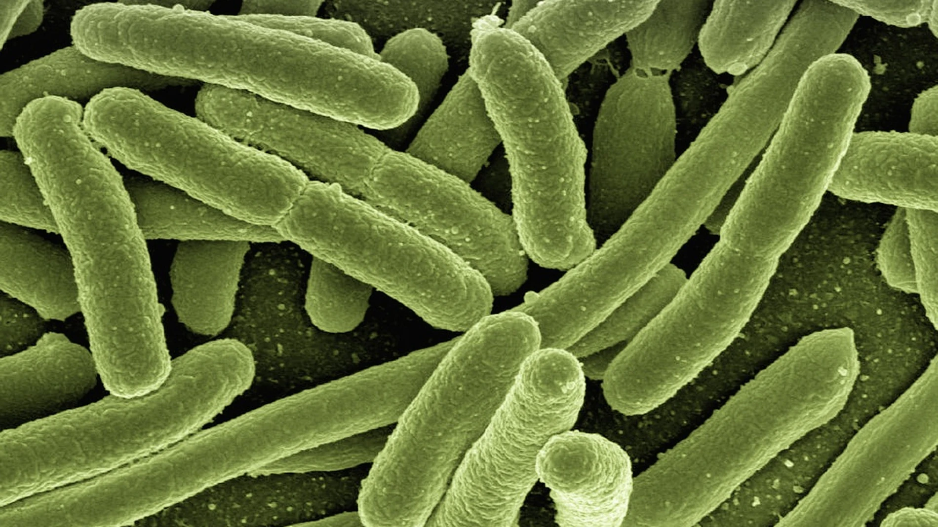Al menos cuatro personas han muerto en Florida en el 2025 por la bacteria come carne