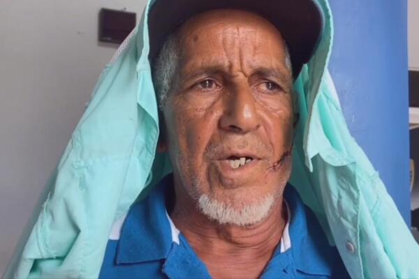 La víctima afirmó que el atacante no tenía ninguna relación con él y que, hasta el momento, no han tenido contacto previo. 