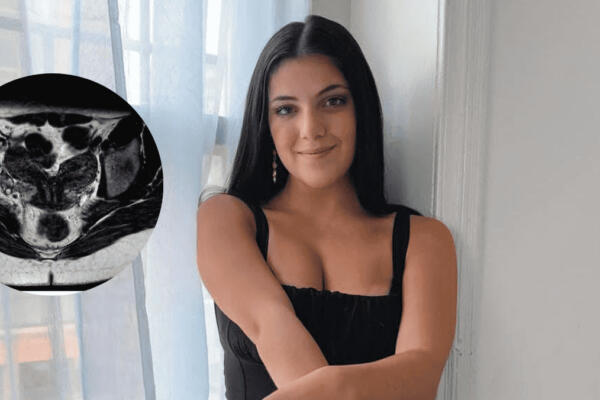 Modelo revela que tiene dos úteros y doble ciclo menstrual