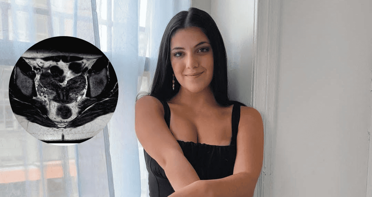 Modelo revela que tiene dos úteros y doble ciclo menstrual
