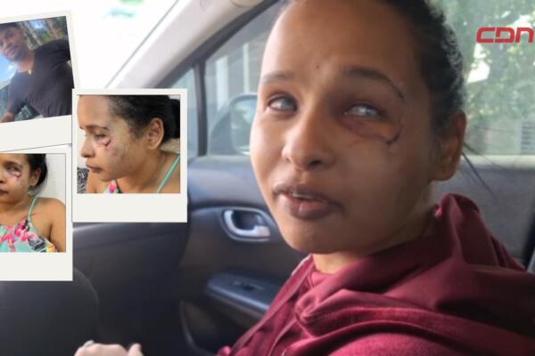 Darlin Esther Pichardo, no vidente agregida por su expareja. 